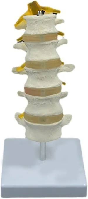 Pathological Lumbar Spine Model Five Segment myxoma factual billion radical investigator Lumbar Spine Anatomy Model for Educational Anatomical Lumbar Spine Model 